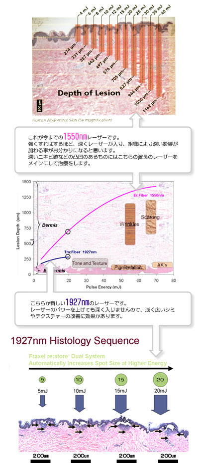 フラクセル3